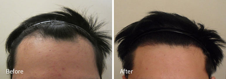 /filedata/md_board/20260102171035_JQhSwAO9_afterEBAAA8EBB09CEC9DB4EC8B9D_3.jpg 전후사진