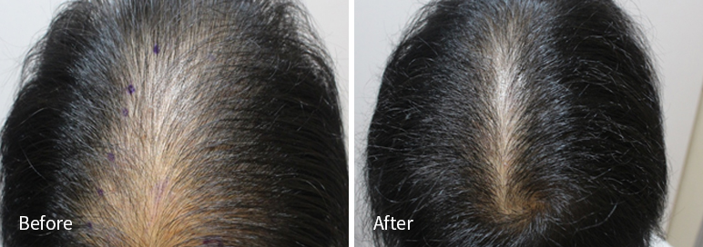 /filedata/md_board/20260102171157_NfTOFcpu_afterEBAAA8EBB09CEC9DB4EC8B9D_6.jpg 전후사진