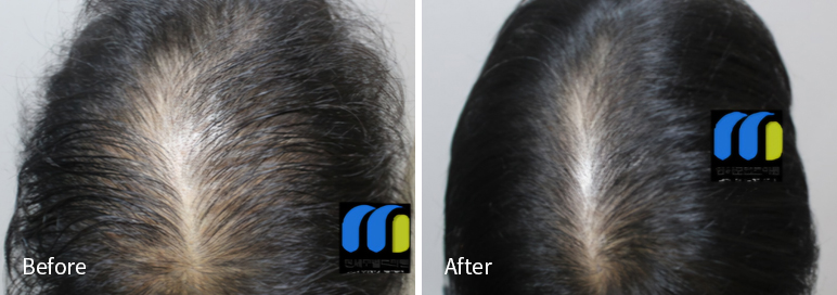 /filedata/md_board/20260102171247_3oXw6sRD_afterEBAAA8EBB09CEC9DB4EC8B9D_8.jpg 전후사진