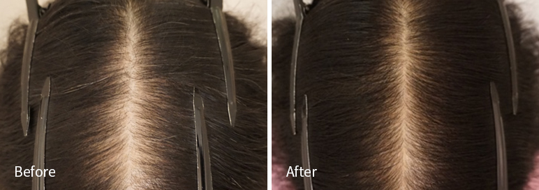 /filedata/md_board/20260102171312_kKtNP9JY_afterEBAAA8EBB09CEC9DB4EC8B9D_9.jpg 전후사진