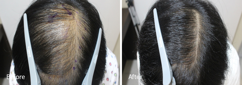 /filedata/md_board/20260102171443_4DZkRPXx_afterEBAAA8EBB09CEC9DB4EC8B9D_13.jpg 전후사진