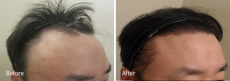 /filedata/md_board/20260102171652_K80lOUBt_afterEBAAA8EBB09CEC9DB4EC8B9D_18.jpg 전후사진