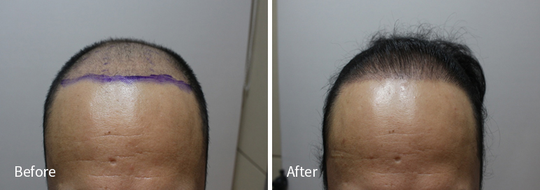 /filedata/md_board/20260102171812_SmDWn9hz_afterEBAAA8EBB09CEC9DB4EC8B9D_22.jpg 전후사진