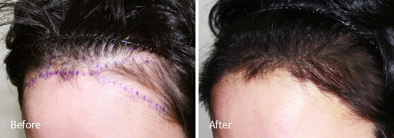 /filedata/md_board/20260102182915_lKXR1pag_afterED97A4EC96B4EB9DBCEC9DB8_3.jpg 전후사진