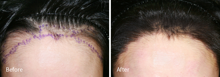 /filedata/md_board/20260102182957_2Wy0YmMu_afterED97A4EC96B4EB9DBCEC9DB8_6.jpg 전후사진